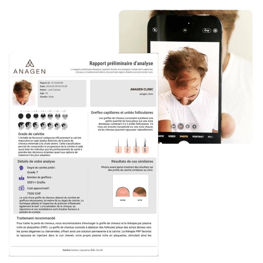 AI Hair Scan Report on smartphone
