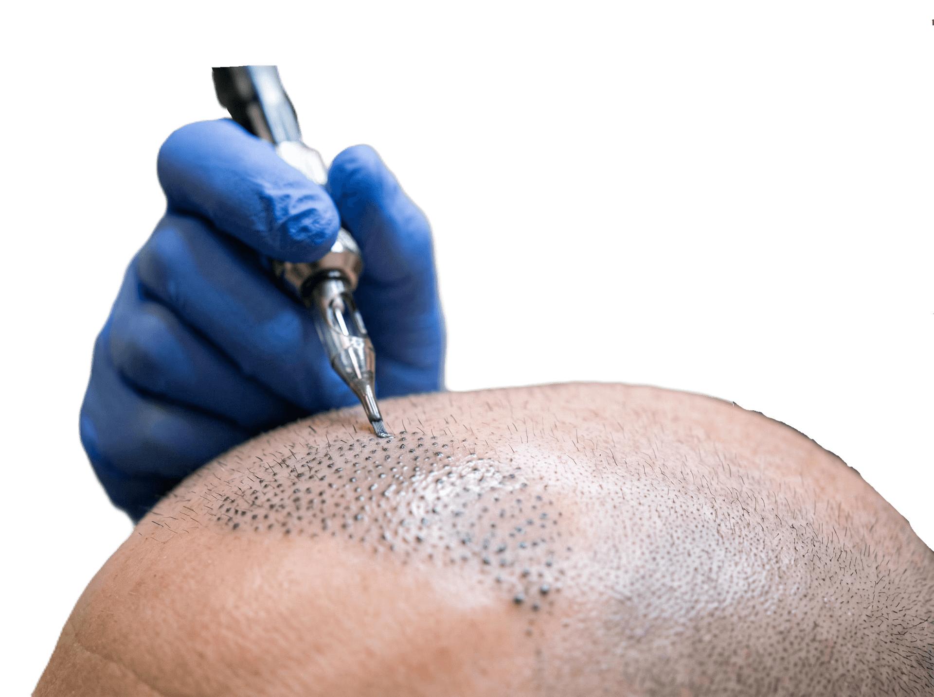 Haarpigmentierung