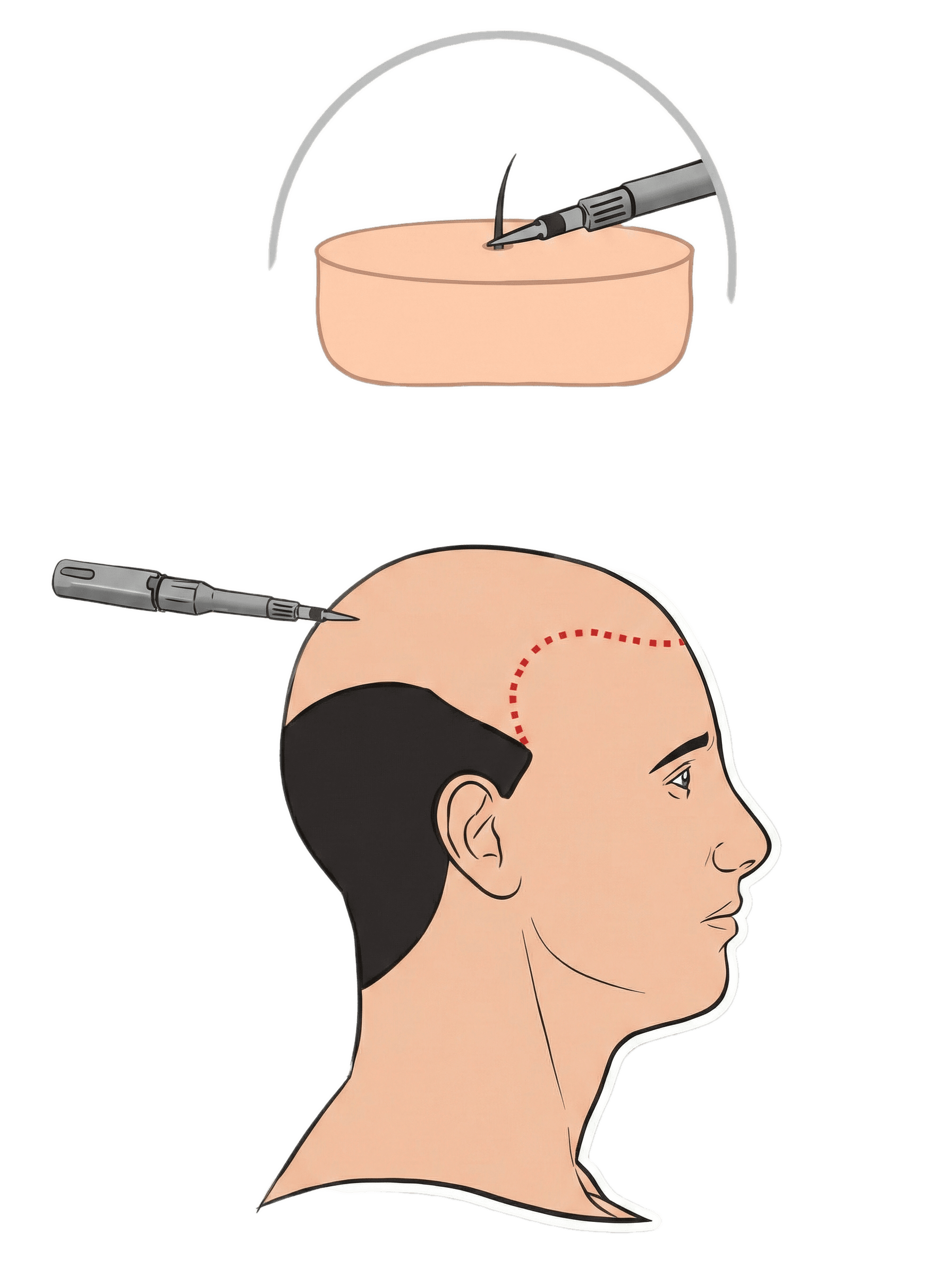 Consultation & Analyse